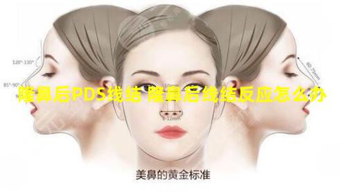 隆鼻后PDS线结 隆鼻后线结反应怎么办